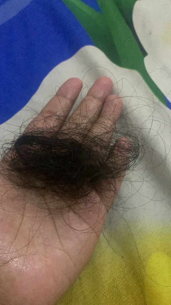 itsmedyn6's tweet photo. spill hair care kalian plisss buat rambut rontokkkk, ini bentukan sekali sisirannn😭😭😭 https://t.co/bpZFUvNP43