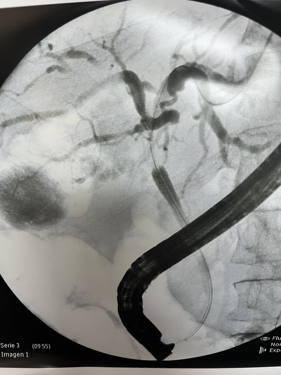 Juan David Espinoza tweet media