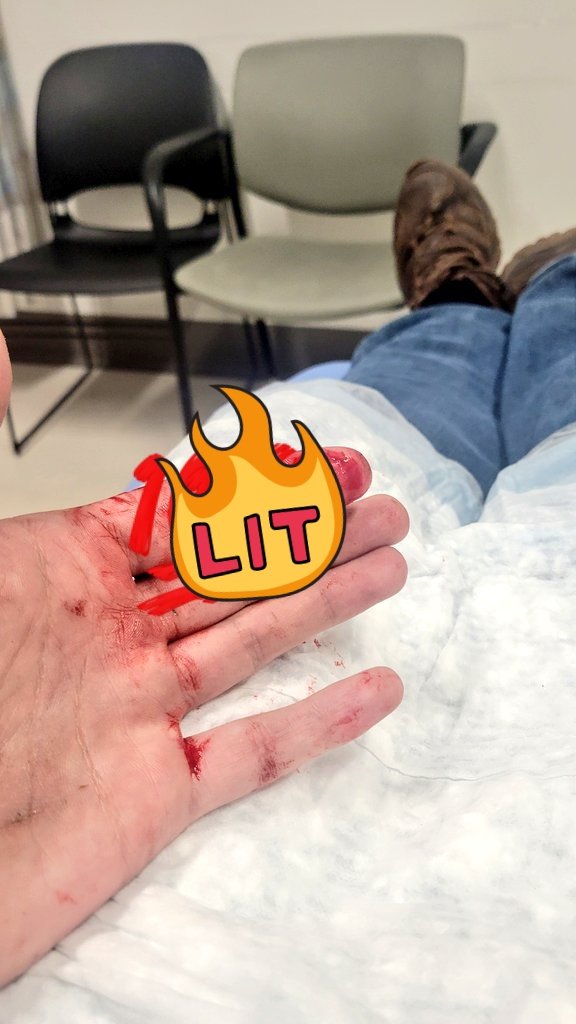 How the fuck do I almost loose a finger on a Bridgeport that's not even running