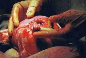 Chile/All Life Matter
Take My Hand NOT My Life
Cardenal Fernando Chomalí 
<a href="/FernandoChomali/">Card. Fernando Chomali</a> 
<a href="/maylwino/">Mariana Aylwin</a> <a href="/EdwardFrei/">Edward Frei</a> 
<a href="/Karenci75407460/">Karen Medina Diputada</a> 
<a href="/hectorbarria/">Hector Barria Diputado✌🏽</a> <a href="/BarriosDiputado/">Diputado Arturo Barrios</a> 
<a href="/checho_hirane/">Checho Hirane</a> 
Rosary for Life!!!!