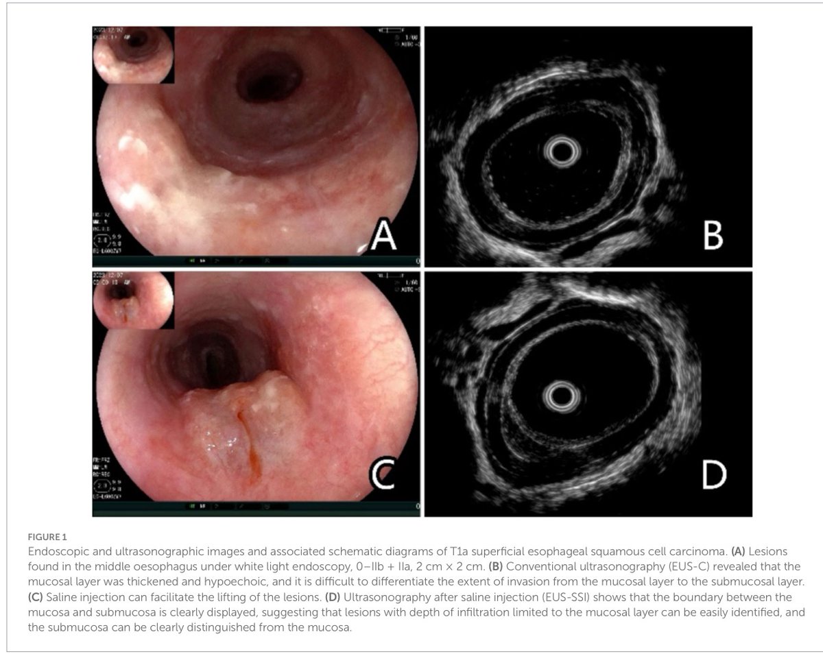 Achintya Singh, MD tweet media