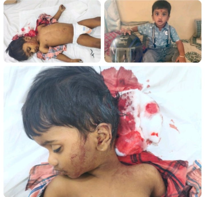 VPKrishna6's tweet photo. @DgpKarnataka @PMOIndia @BlrCityPolice @CMofKarnataka @CMOfficeUP @DCPTrEastBCP @dcpwhitefield @KRPURATRAFFIC @DKShivakumar @GBA_office @IndiaPostOffice @narendramodi #JusticeforTrishulAbhyaan
#NationWTchingKithaganuru
Two year old Trishul lost his life in Half way halted pending PWD Road work issue https://t.co/aoWFMH93mK