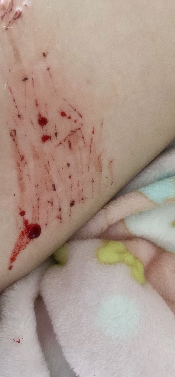 ke daron dela canina