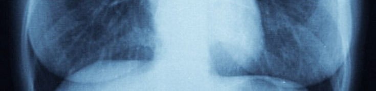 When I hear my mom voice after a bad day