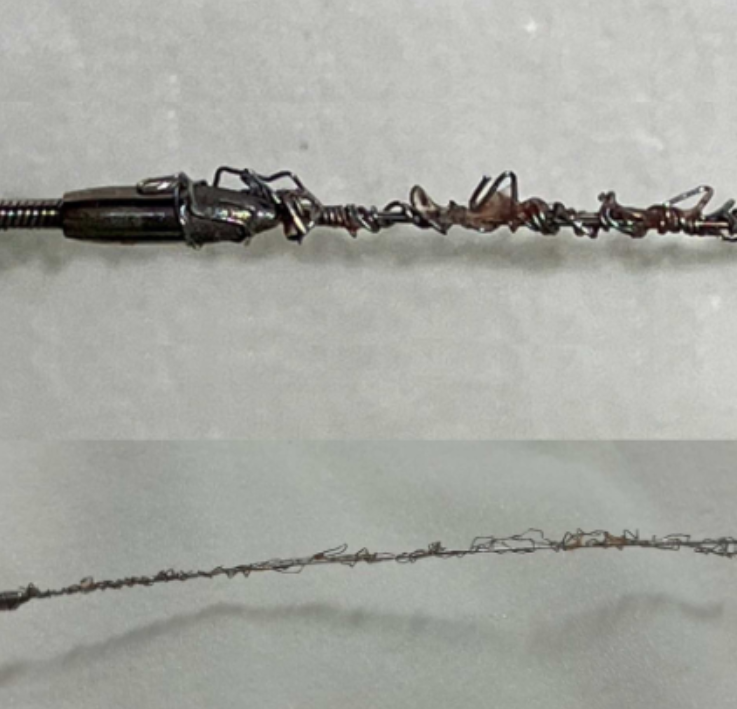 gbiondizoccai's tweet photo. I hope it never happens to me: percutaneous en bloc extraction of a rotablator burr stalled within a stent, with stent and guidewire! https://t.co/xpPZGgJQ8K @ccijournal https://t.co/dm2WkliRTc