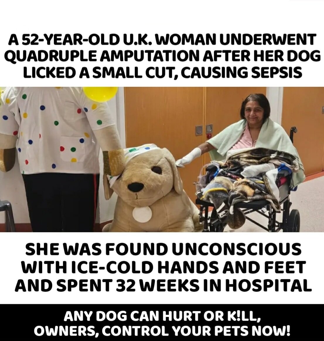 PET DOG MENACE :-

A 52-YEAR-OLD WOMAN UNDERWENT QUADRUPLE AMPUTATION AFTER HER PET DOG LICKED A SMALL CUT, CAUSING HER SEPSIS..
​SHE WAS FOUND UNCONSCIOUS WITH ICE-COLD HANDS AND FEET AND SPENT 32 WEEKS IN HOSPITAL..
​ANY DOG CAN HURT OR K!LL THE HUMANS.. CONTROL YOUR PETS NOW..