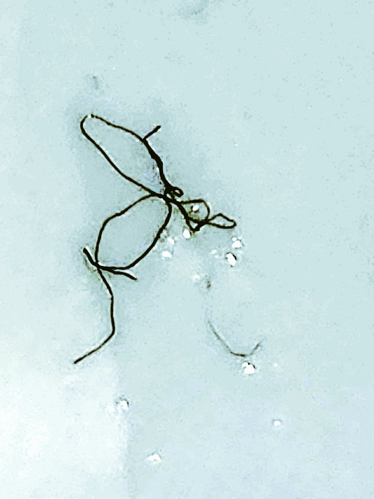 ABD - CIA MKULTRA BELGESİ diyor ki ‼️

Yiyeceklere, suya, Coca-Cola'ya, alkole, sigaralara ve hatta aşılara yerleştirilen maddeler, zamanla yavaş yavaş kaygı, umutsuzluk, gerginlik ve depresyona sebeb oluyor.

Üstü çizili alanda yazanlar : 

"Bu ikinci tip ilaç, uzun bir süre