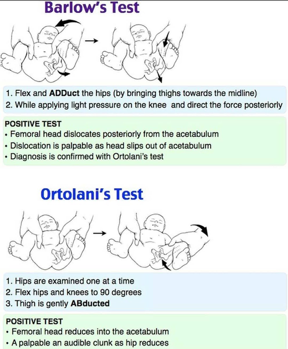 <a href="/shakilED/">Shakil Ahmed</a> <a href="/AnushkaMoray/">Anushka</a> <a href="/dr_manish_ydv/">अहिरावण</a> <a href="/Dr_Shiv_kumar_/">Dr. Shiv_Kumar</a> <a href="/SameerYogi14/">Dr Ajay yadav</a> <a href="/drabdulhameed07/">Dr Abdul Hameed 🩺</a> <a href="/DrsansariOrd/">Haji Siyamuddin ANSARI</a> <a href="/sadiairum990/">Dr. Sadia Irum 🇺🇸</a> <a href="/fzn733/">Faizan A.</a> <a href="/albertoortegana/">C.Alberto Ortega</a> <a href="/MiguelP23970914/">Antonio Arroyo, MD. Medico Cirujano.</a> I was assessed on this when I was a student fan fact I had forgotten of both maneuvers but I heard the prof asking another student and said the names with very funny explanations
<here>