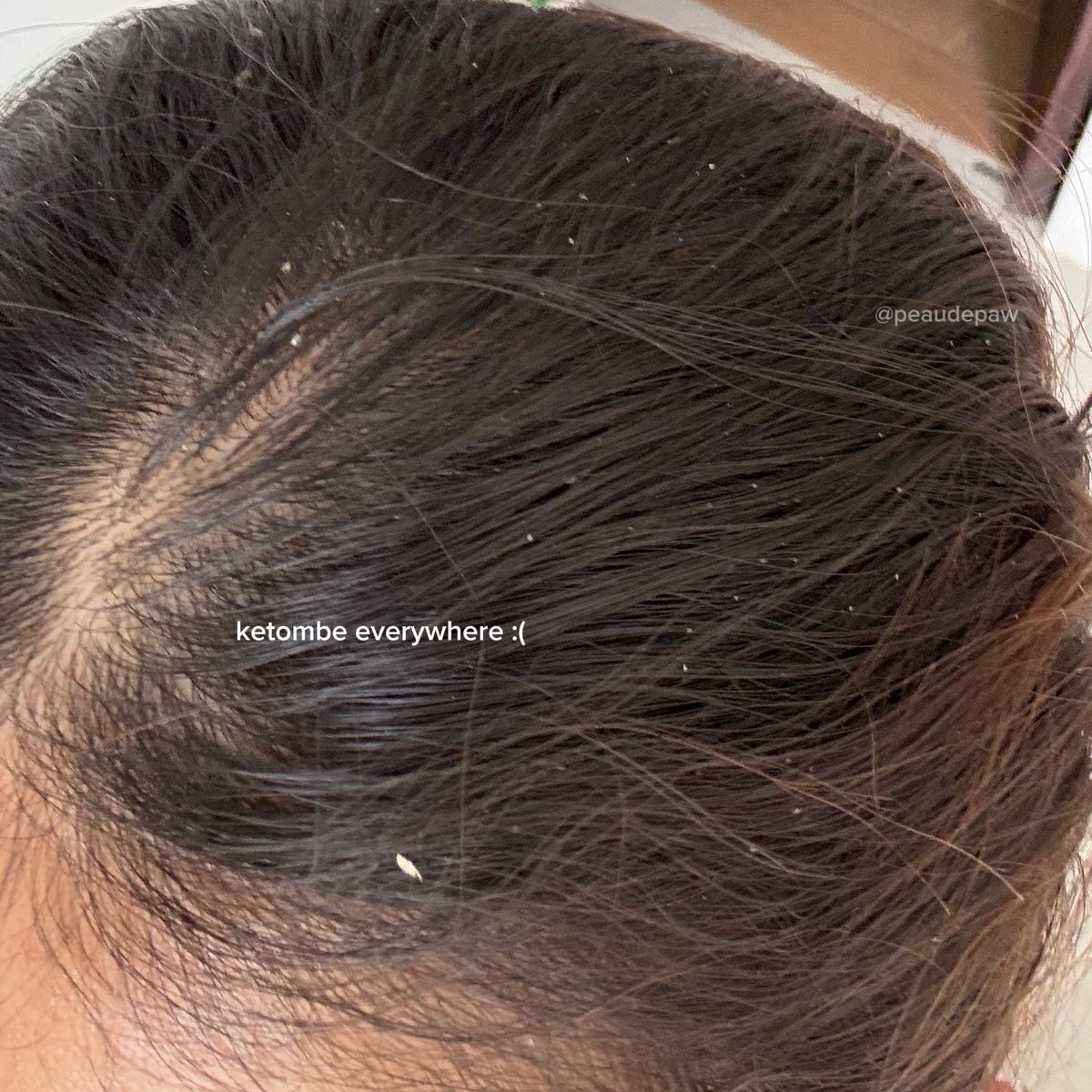 selama ini baru paham kenapa tiap puasa jadi ketombean….