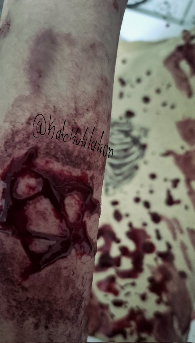 KateMutilation's tweet photo. #shtwt https://t.co/9ceeymanhK