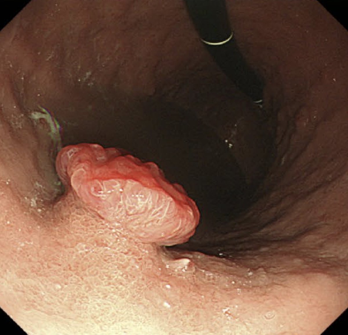 Keith Siau tweet media