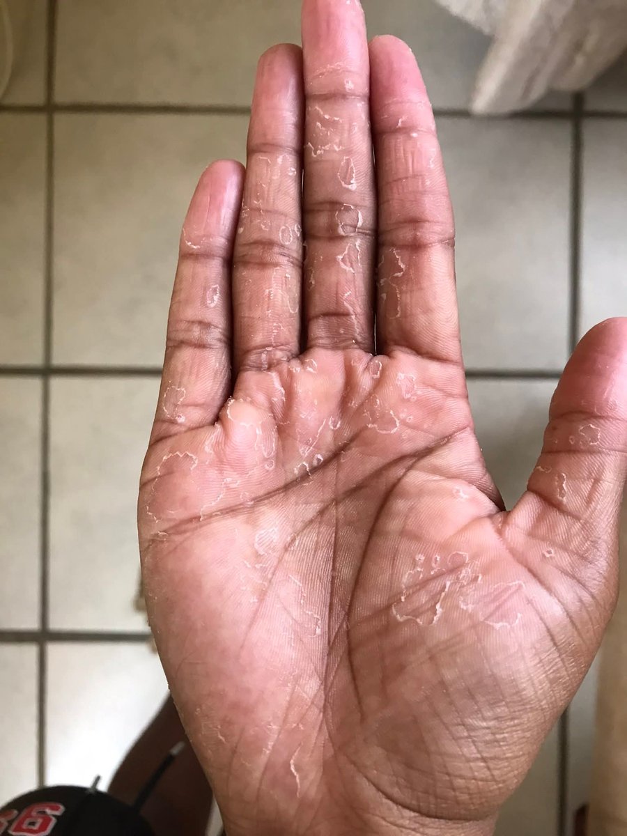 What causes this problem?