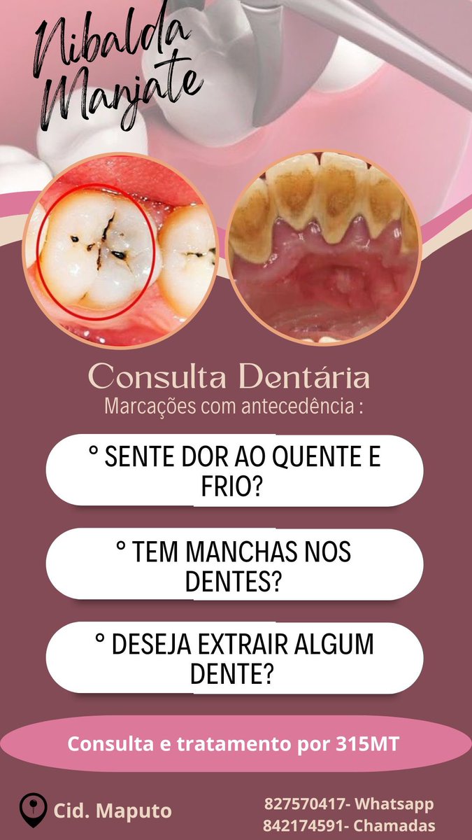 Os atendimentos são realizados na clínica do ISCTEM, sou estudante de Medicina Dentária e os procedimentos são feitos sob supervisão. Antes da marcação, é necessário entrar em contacto pelos números indicados para explicar o procedimento desejado, para que possamos avaliar o caso