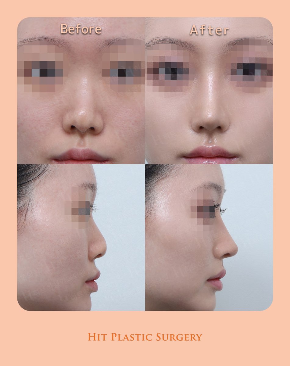 ヒット整形外科 tweet media