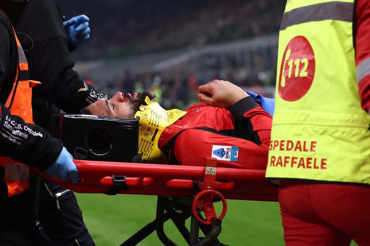 OUCH 😣 

Milan star Ruben Loftus-Cheek shares a gruesome aftermath photo of his injury against Parma on Sunday night - a fractured jaw that may damage his World Cup hopes! 💔 

The former Chelsea player will spend up to 8 weeks on the sidelines.

#ACMilan | #WorldCup |