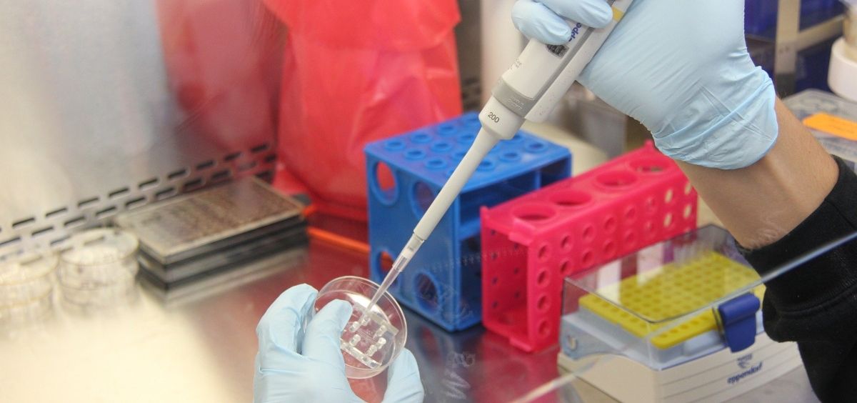SaluDigital_CS's tweet image. 🦠Un estudio identifica a las células madre responsables de la recurrencia del #cáncer gástrico, marcadas por la proteína AQP5

Al eliminarlas en modelos de laboratorio, los tumores dejaron de crecer y no reaparecieron, incluso con #metástasis

consalud.es/saludigital/tr…