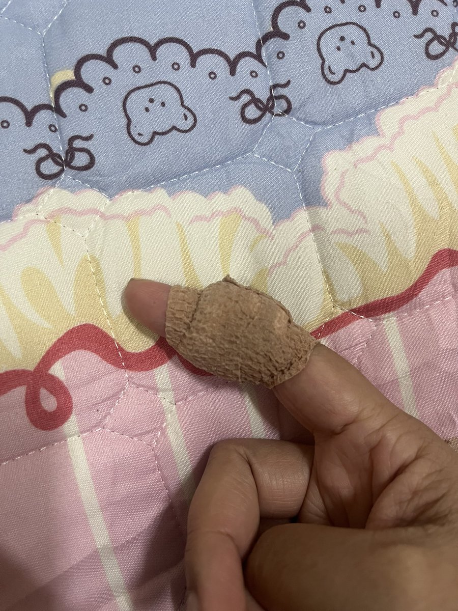 ผ่าแล้วสบายใจ!! ก็บ้าแล้วรอยาชาหมดฤทธิ์ก่อนนะ ไปหาหมอตั้งแต่แรกก็จบแล้วเนี่ยรอให้ยิ่งใหญ่ทำไม 55555