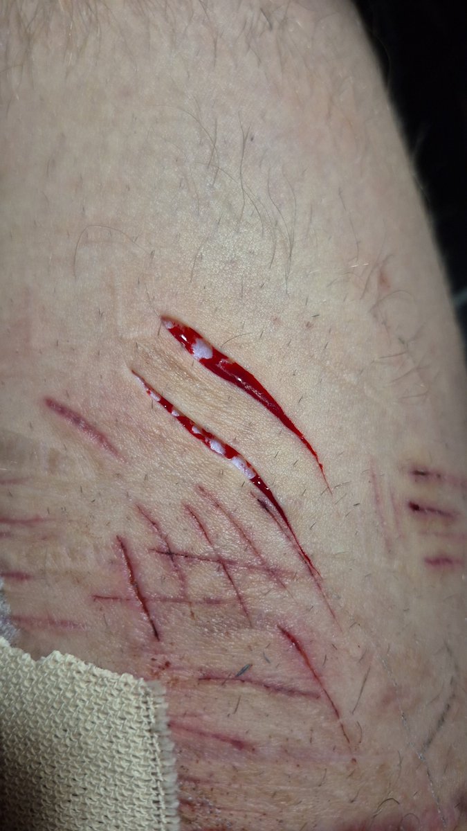 __death__00's tweet photo. @Qyujianng Need more razors https://t.co/AjnlfqZnnn