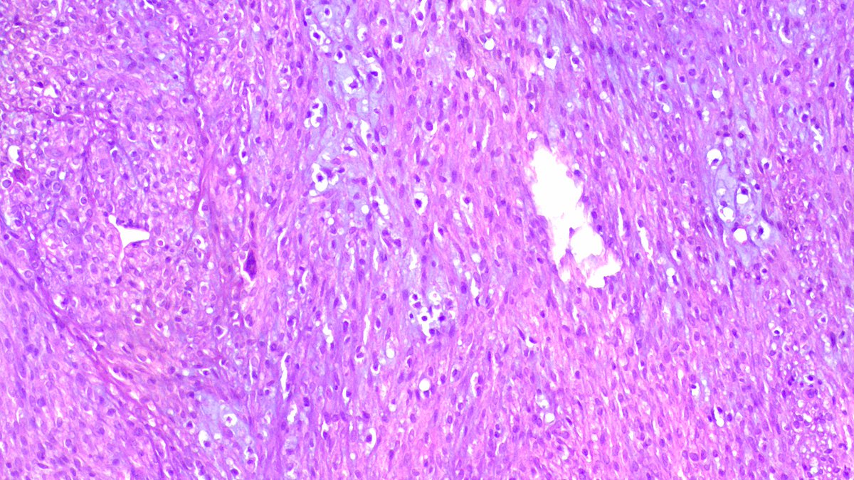 Wondweson64 Alemu tweet media