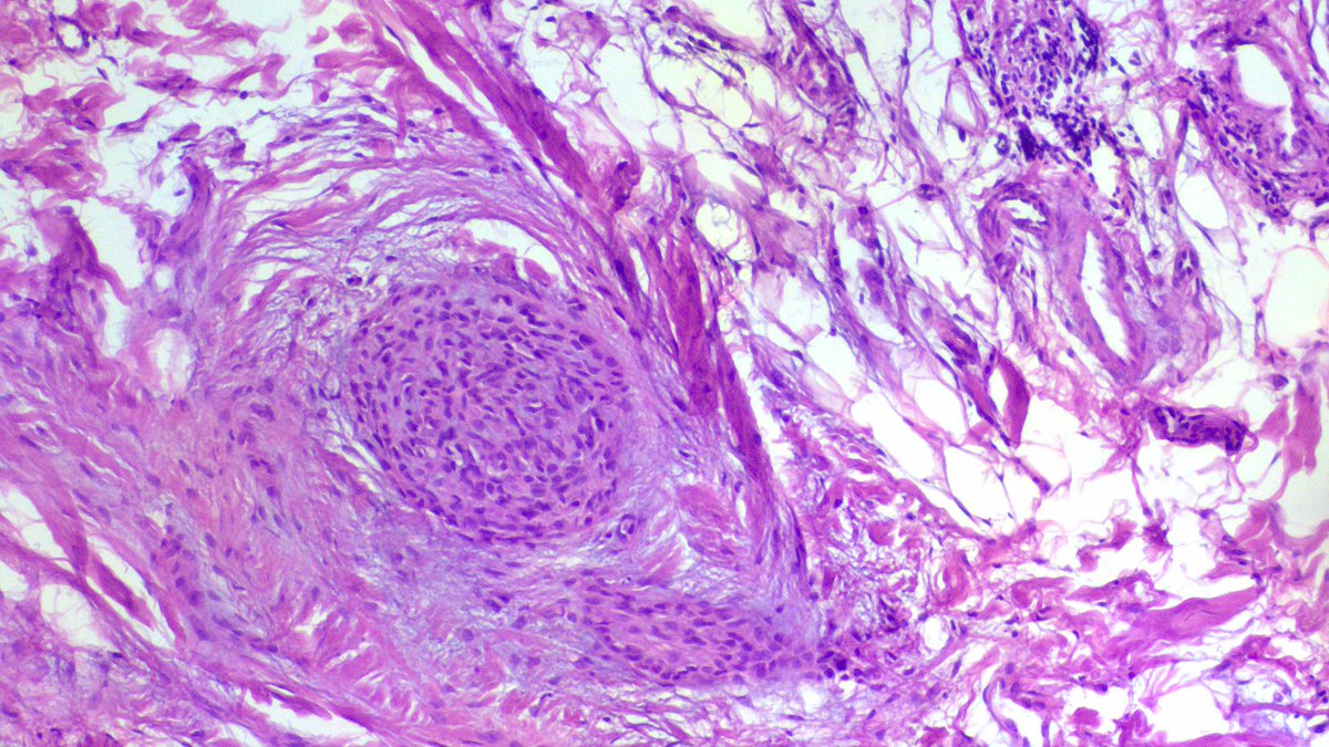 Wondweson64 Alemu tweet media