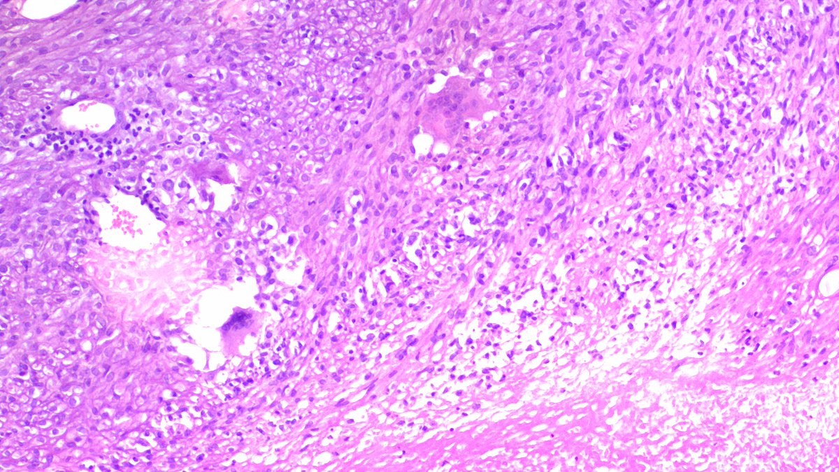 Wondweson64 Alemu tweet media