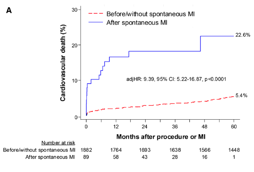 Juan Pablo Costabel MD 🇦🇷 tweet media
