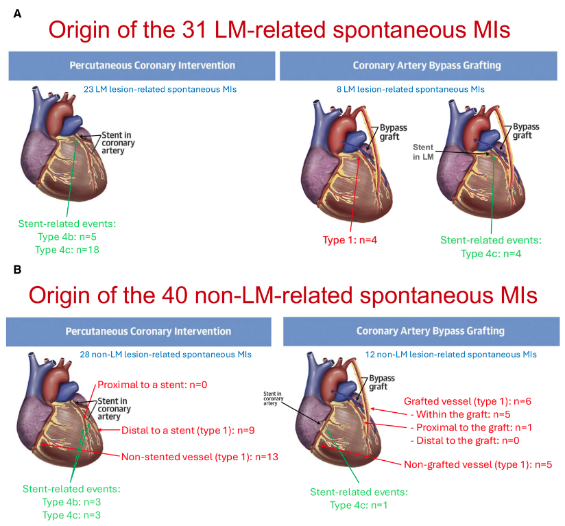 Juan Pablo Costabel MD 🇦🇷 tweet media