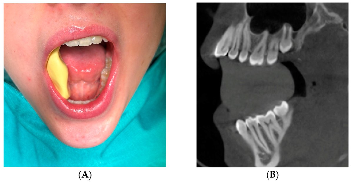 Bioengineering MDPI tweet media