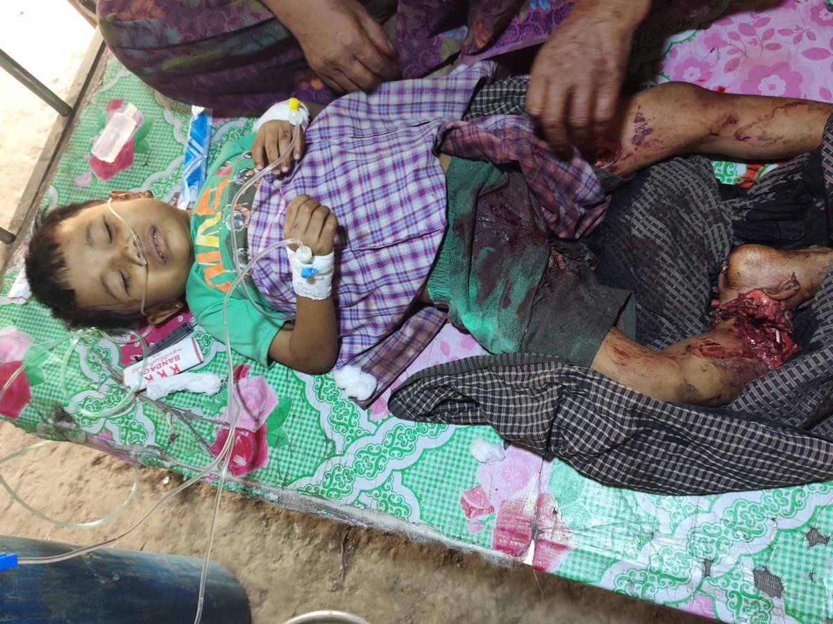 Revealed_Arakan's tweet photo. The Fascist Terrorist Myanmar Military Junta (SAC) Airstrike Devastates Civilian Market in Yoe Ngu Village, Ponnagyun Township, Arakan

Arakan, February 24, 2026
By Revealed

A military airstrike launched by Myanmar’s ruling junta tore into a crowded marketplace in Yoe Ngu village, Ponnagyun Township, leaving devastating civilian casualties, according to local residents and community sources.

At least 20 civilians are reported dead, including children. Many others suffered severe injuries, with several in critical condition. Survivors described scenes of horror and confusion as powerful explosions ripped through market stalls and shattered nearby homes, turning a place of daily livelihood into a site of bloodshed.

The Fascist Terrorist Myanmar Military Council (SAC) continues to attack civilian-populated areas across Arakan by air, sea, and heavy artillery on a near-daily basis, systematically committing ongoing war crimes against the people.
