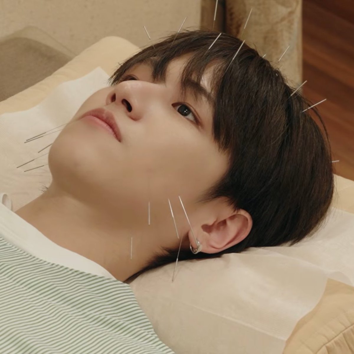 아니 리우 얼굴에 침이 몇개나 꽂힌 거야 제발