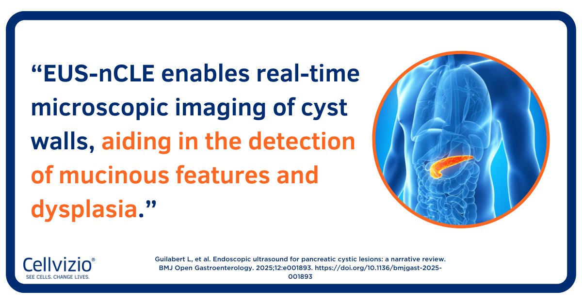 Cellvizio® by Mauna Kea Technologies tweet media