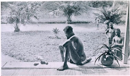 FotosDeFatos's tweet photo. Um pai olha para a mão e pé de sua filha de cinco anos, punida porque sua aldeia produziu pouca borracha. Maio de 1904, Congo sob o rei Leopoldo II. Foto tirada pela missionária e ativista dos direitos humanos Alice Seeley Harris. https://t.co/CpjqtT7oHh