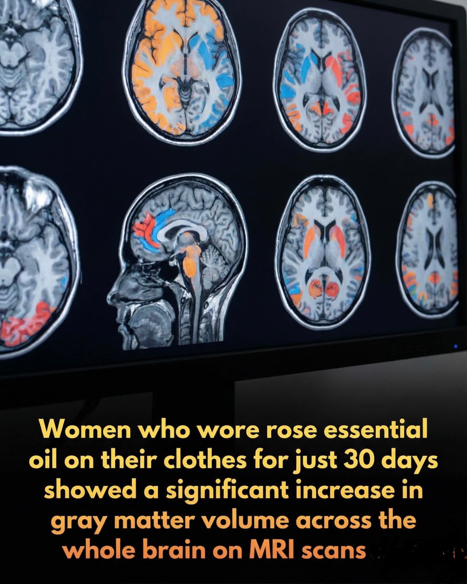 🚨 New research reveals that smelling rose essential oil for just 30 days can physically expand your brain’s gray matter.

A groundbreaking study has discovered that the simple act of wearing rose essential oil can lead to visible structural changes in the human brain. Over a