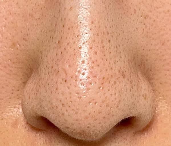 ASLIIII produknya Dermalogica Daily yg ini tuh sering banget sliweran…. jd penasaran karna katanya bisa hempas sebaceous filament???