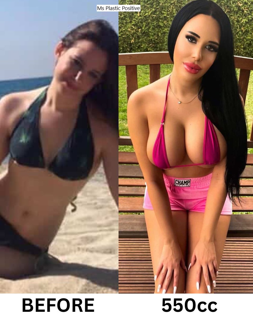 Ms Plastic Positive tweet media