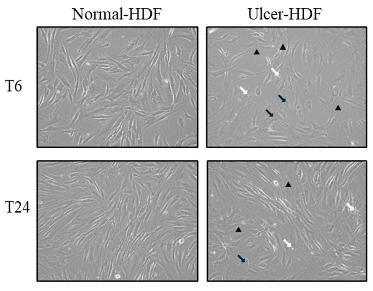 Bioeng_MDPI's tweet photo. 💥Highly recommended publication: "Pulsed Radiofrequency Electromagnetic Fields as Modulators of Inflammation and Wound Healing in Primary Dermal Fibroblasts of Ulcers"
🔗https://t.co/geDxuqNzXT
📌#WoundHealing #TissueRepair #MedTech https://t.co/TpDmMFIhDe
