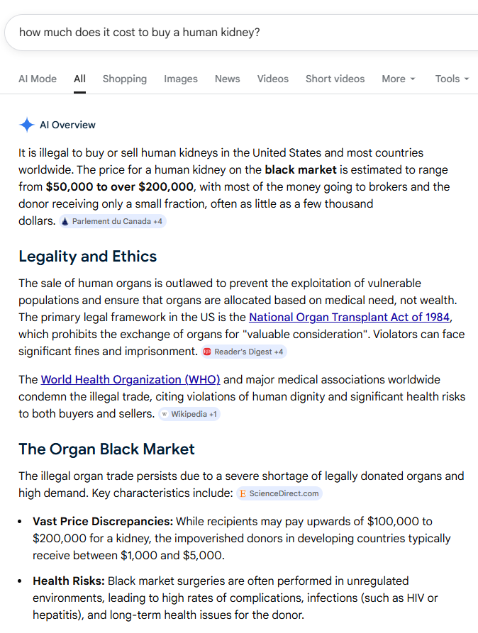 So why are Israelis harvesting organs from Palestinian prisoners and then murdering them?
Well it turns out that a human kidney is worth anything from $50,000 to $200,000 on the black market.
Even in death, there's no end to the abuse Palestinians receive from Israeli genociders