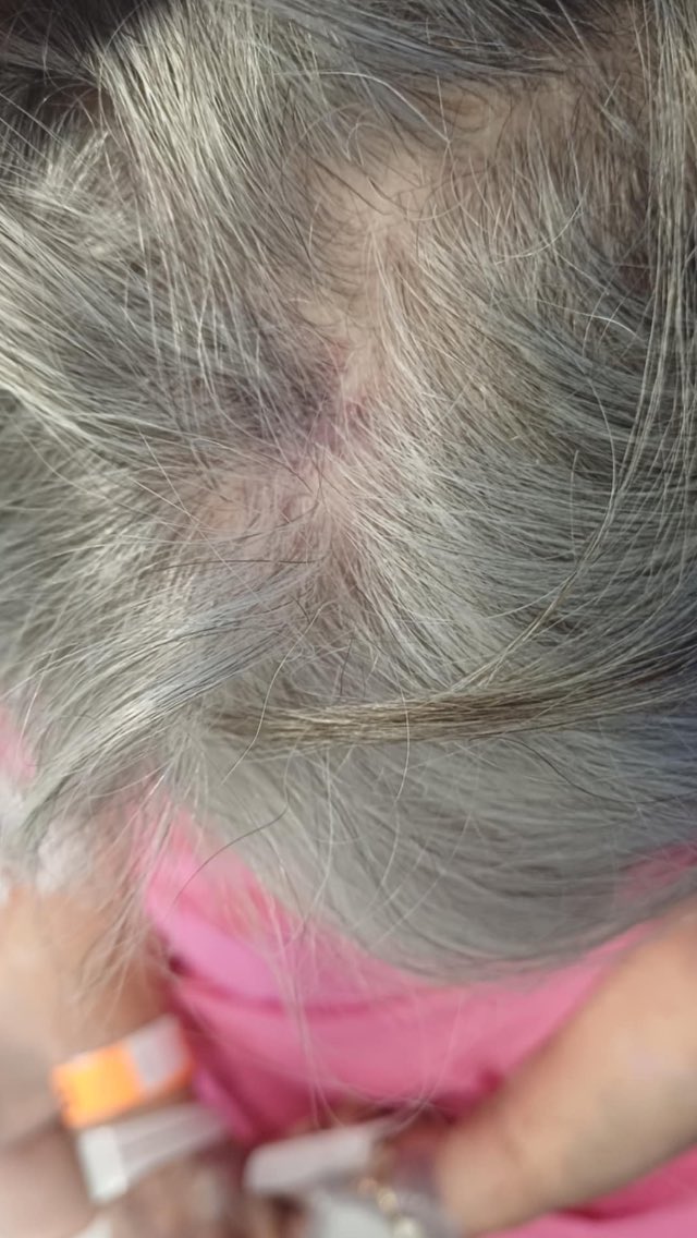 Yesterday my moms mobility scooter toppled over after falling down a pothole . The roads are an absolute disgrace. What are they spending Road  tax on!?