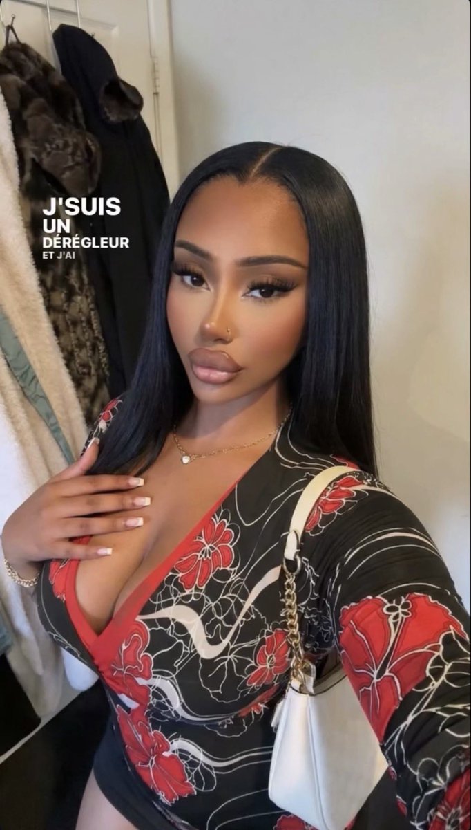 KIRBY 🇯🇲 tweet media