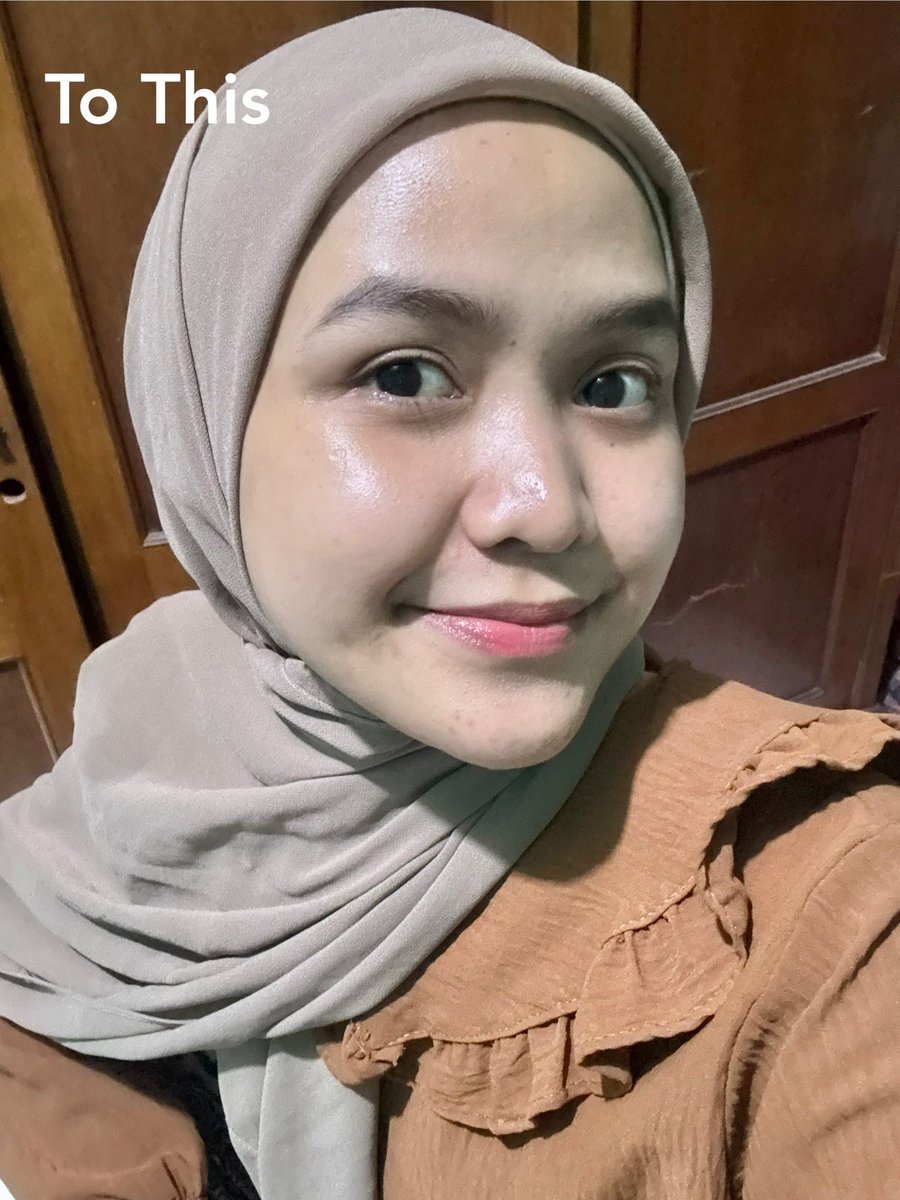 Memulai ramadhan dengan treatment harga diskonan 

Woww.. welcoming the glass skin era✨