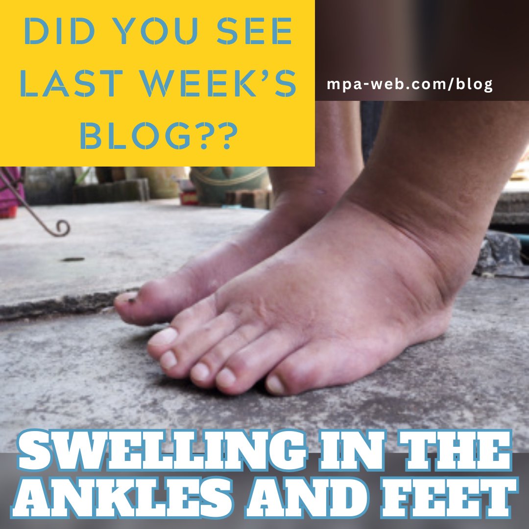 Because the feet/ankles sit far from the heart, they are sensitive to changes in circulation/pressure. We can assess the swelling, skin/nail health, and circulation to identify if the cause is mechanical, inflammatory, or due to an underlying condition.

mpa-web.com/blog/item/1311…