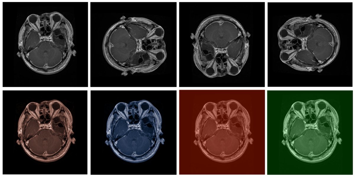 Bioeng_MDPI's tweet image. 💥Highly recommended publication: "Lightweight Super-Resolution Techniques in Medical Imaging: Bridging Quality and Computational Efficiency"
🔗shorturl.at/j5UN3
📌#MedicalImaging #DeepLearningAI #HealthAI
