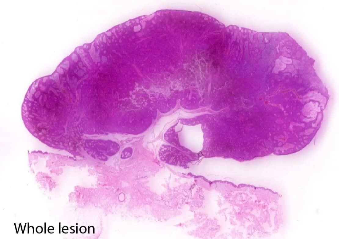 aung phyo tweet media