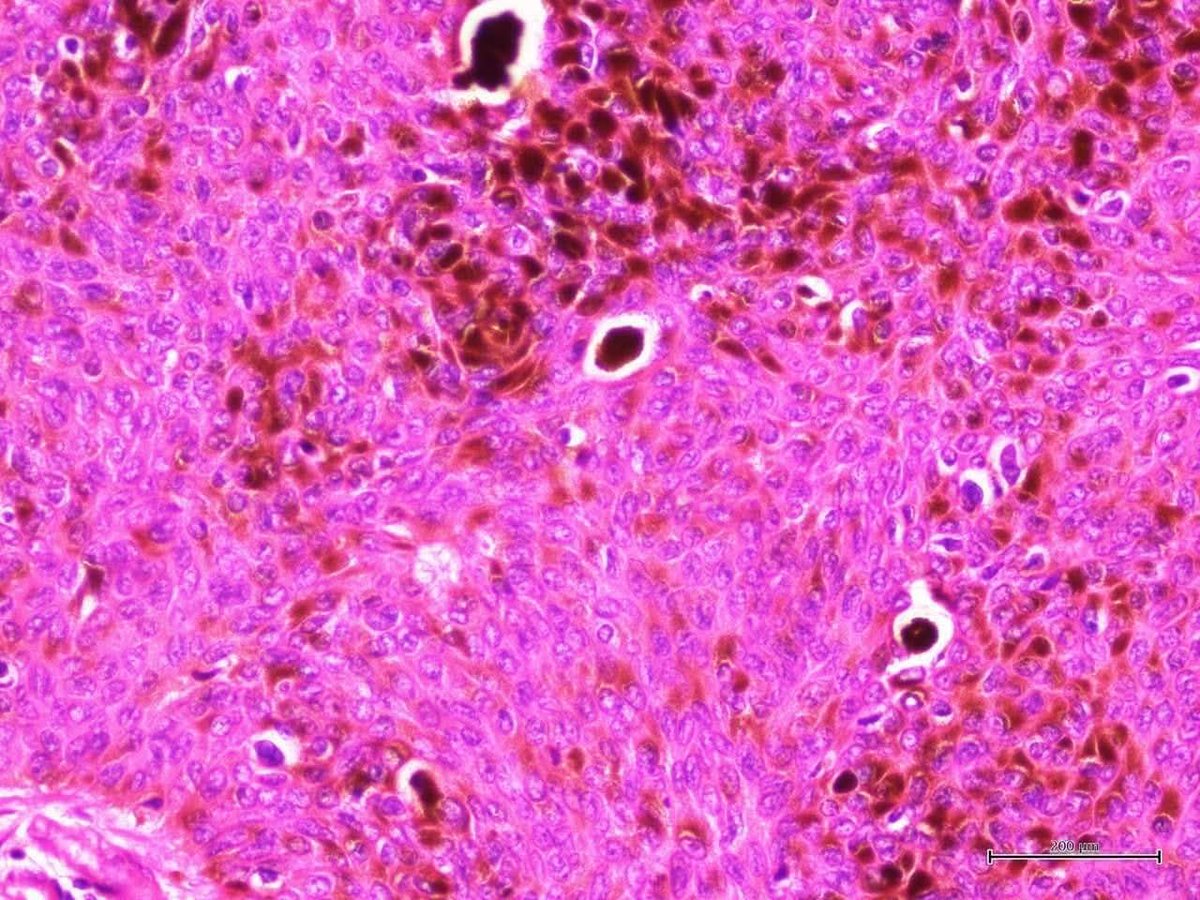 aung phyo tweet media