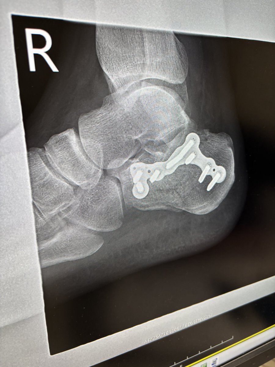 北村|調圧ニキ🪼|瞬速整体(調圧法®)創始者 (@chouatsuhou) / Posts / X