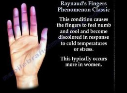 Atomic Asphalt tweet media