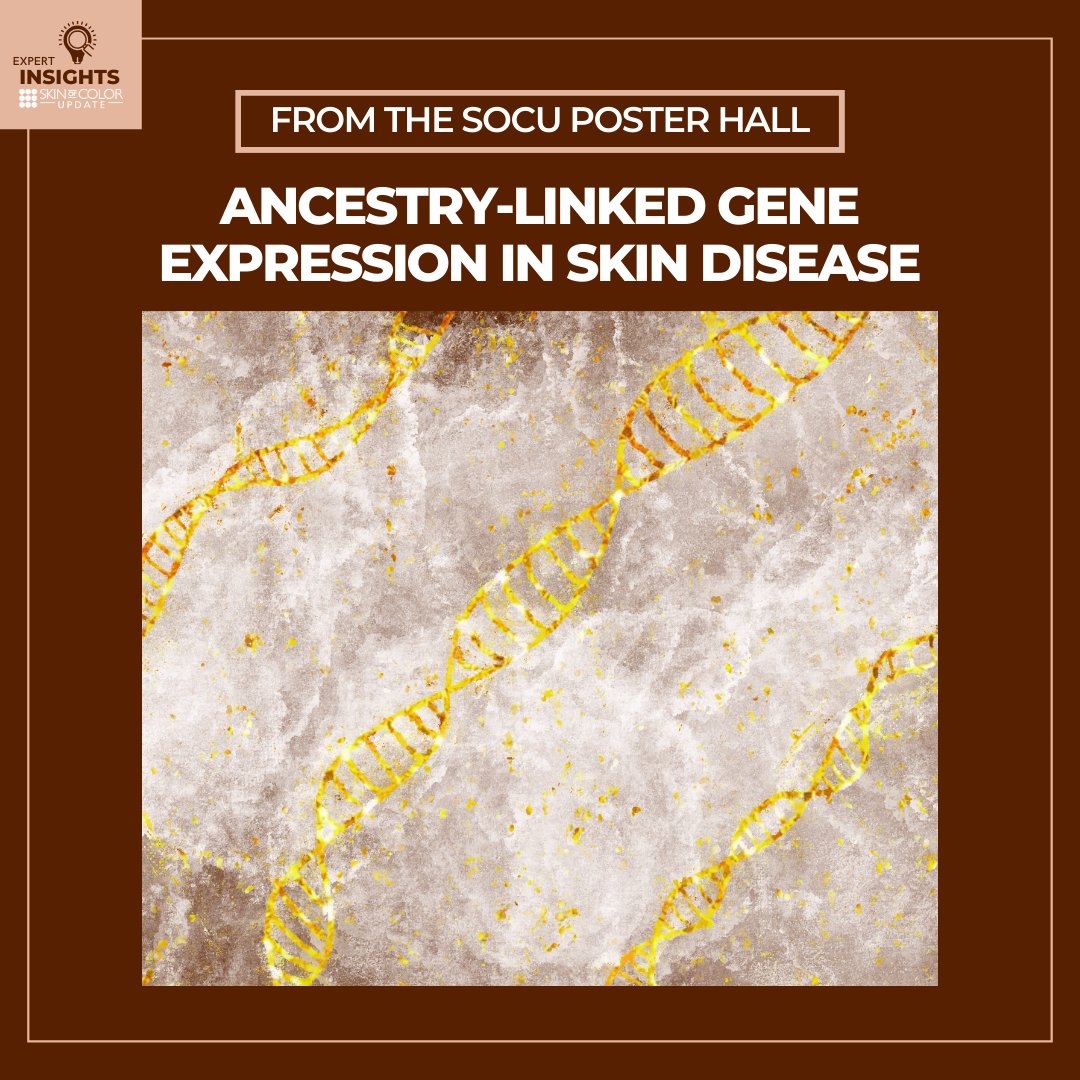 SkinOfColorDerm's tweet photo. New research presented at Skin of Color Update highlights how genetic ancestry may better explain differences in gene expression than self-identified race: https://t.co/r96tGv72oZ

#PrecisionMedicine #GeneticAncestry #HealthEquity #DermResearch #DermatologyEducation https://t.co/VhThoyc674