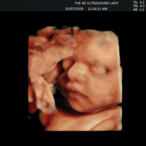 The4DLady's tweet image. 28 week old baby girl imaged in HD Live#4Dultrasound #HDultrasound #5D #Ultrasound #pregnancy