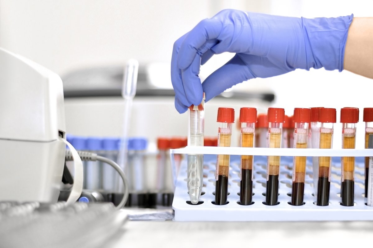 Alzheimer's Drug Discovery Foundation tweet media