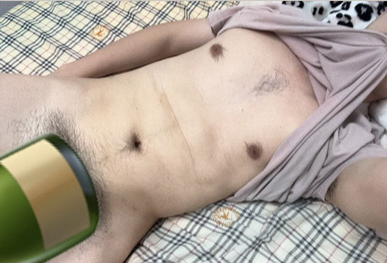 庵俺胺闇 tweet media